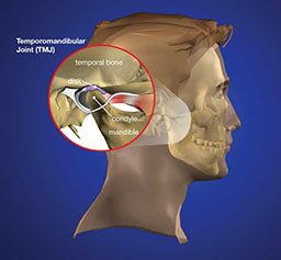 Illustration of TMJ on a man's head