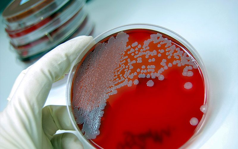 In the left, gloved hand of a researcher, is a red Petri dish.