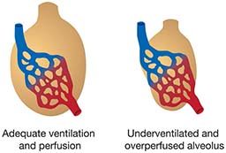 An illustration shows side-by-side of adequate and inadequate ventilation