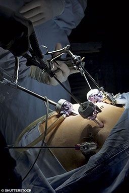 Doctors perform bariatric surgery on a patient