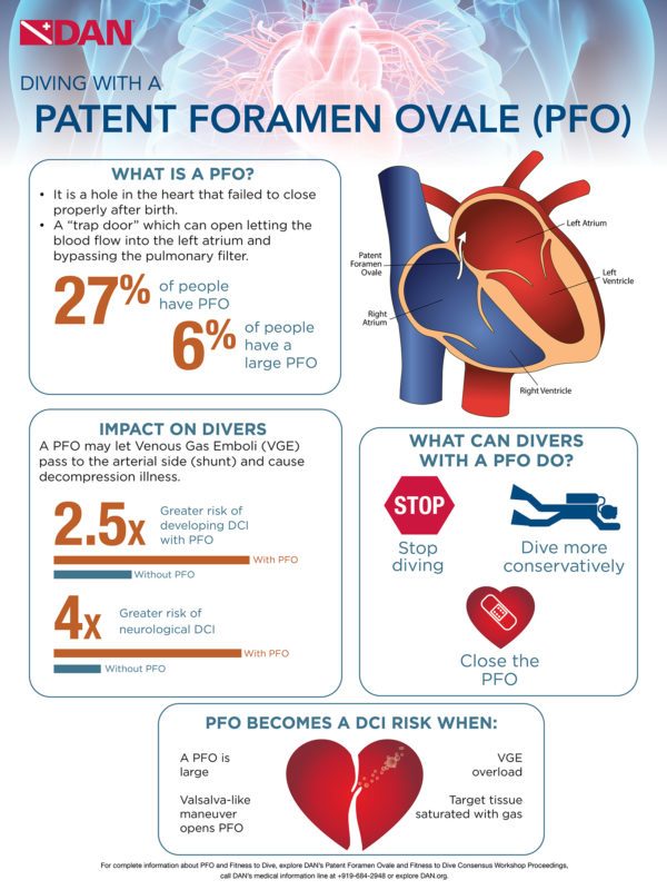 Guidelines for Patent Foramen Ovale and Diving Divers Alert Network