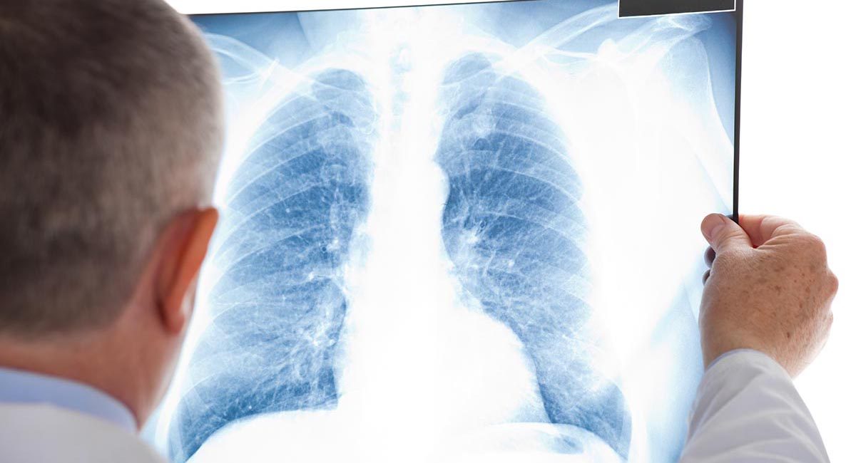 Recognizing Lung Conditions Divers Alert Network