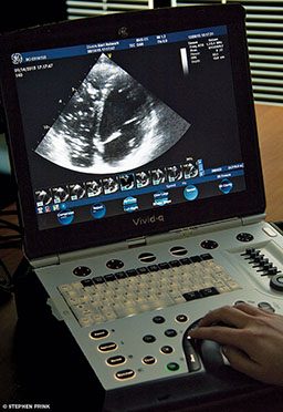 A person works an ultrasound machine that shows bubbles in a heart