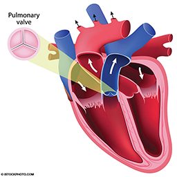 A colorful illustration of the heart that shows the pulmonary valve