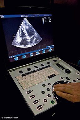 A left hand controls an ultrasound machine with bubbled lungs on the screen