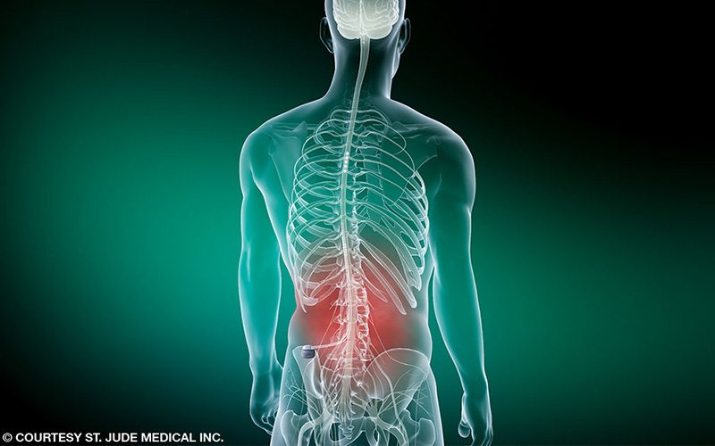 Illustration of skeleton with back pain