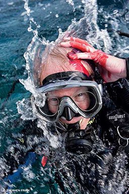 Diver surfaces with a bleeding head wound