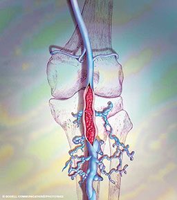 Illustration of a bone with blue veins