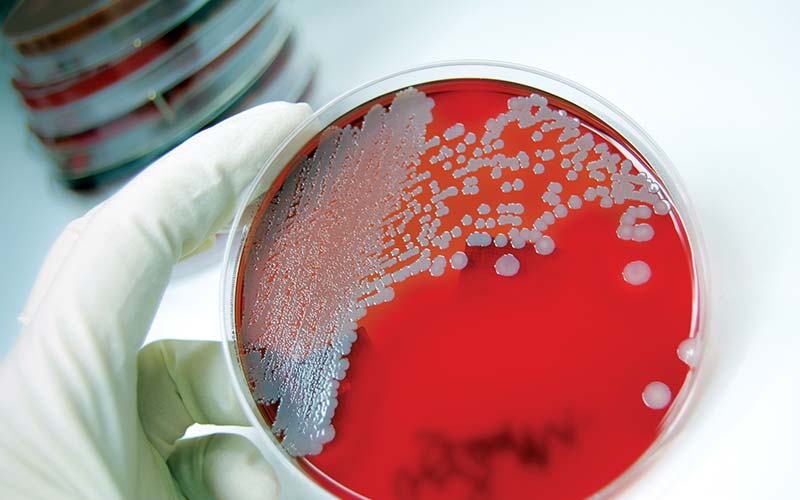 Red culture dish shows bacteria growth