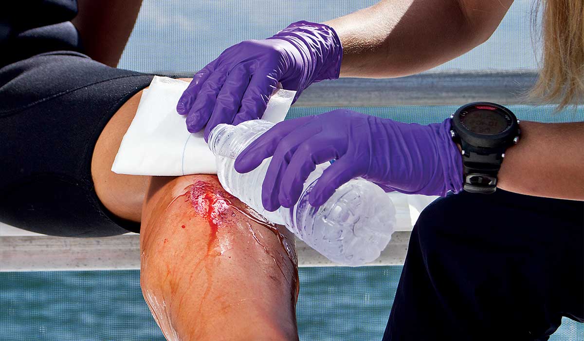 Pair of gloved hands rinses a leg wound using bottled water and a towel